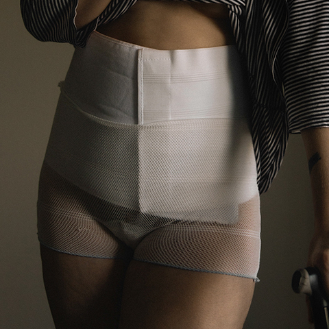 Close-up of a person wearing a striped shirt, white abdominal binder, white medical compression shorts, and holding a black cane.
